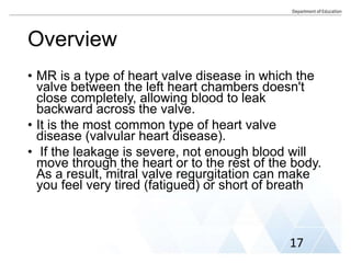 Overview
• MR is a type of heart valve disease in which the
valve between the left heart chambers doesn't
close completely, allowing blood to leak
backward across the valve.
• It is the most common type of heart valve
disease (valvular heart disease).
• If the leakage is severe, not enough blood will
move through the heart or to the rest of the body.
As a result, mitral valve regurgitation can make
you feel very tired (fatigued) or short of breath
17
 