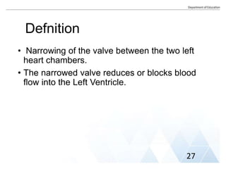 Defnition
• Narrowing of the valve between the two left
heart chambers.
• The narrowed valve reduces or blocks blood
flow into the Left Ventricle.
27
 