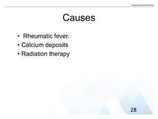 Causes
• Rheumatic fever.
• Calcium deposits
• Radiation therapy
28
 