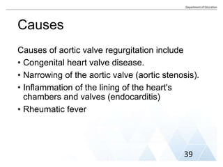Causes
Causes of aortic valve regurgitation include
• Congenital heart valve disease.
• Narrowing of the aortic valve (aortic stenosis).
• Inflammation of the lining of the heart's
chambers and valves (endocarditis)
• Rheumatic fever
39
 