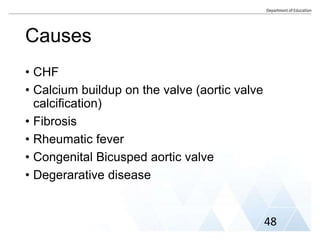 Causes
• CHF
• Calcium buildup on the valve (aortic valve
calcification)
• Fibrosis
• Rheumatic fever
• Congenital Bicusped aortic valve
• Degerarative disease
48
 
