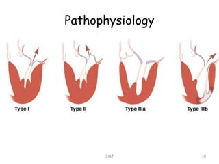 Pathophysiology
JMJ 10
 