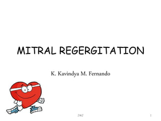 MITRAL REGERGITATION
K. Kavindya M. Fernando
JMJ 1
 