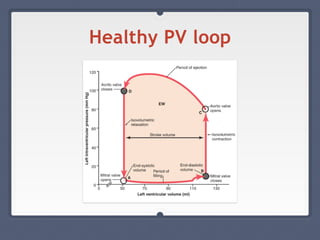 Healthy PV loop
 