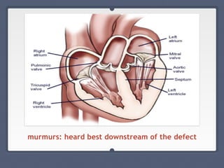 murmurs: heard best downstream of the defect
 