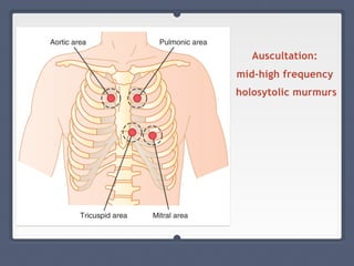 Auscultation:
mid-high frequency
holosytolic murmurs
 