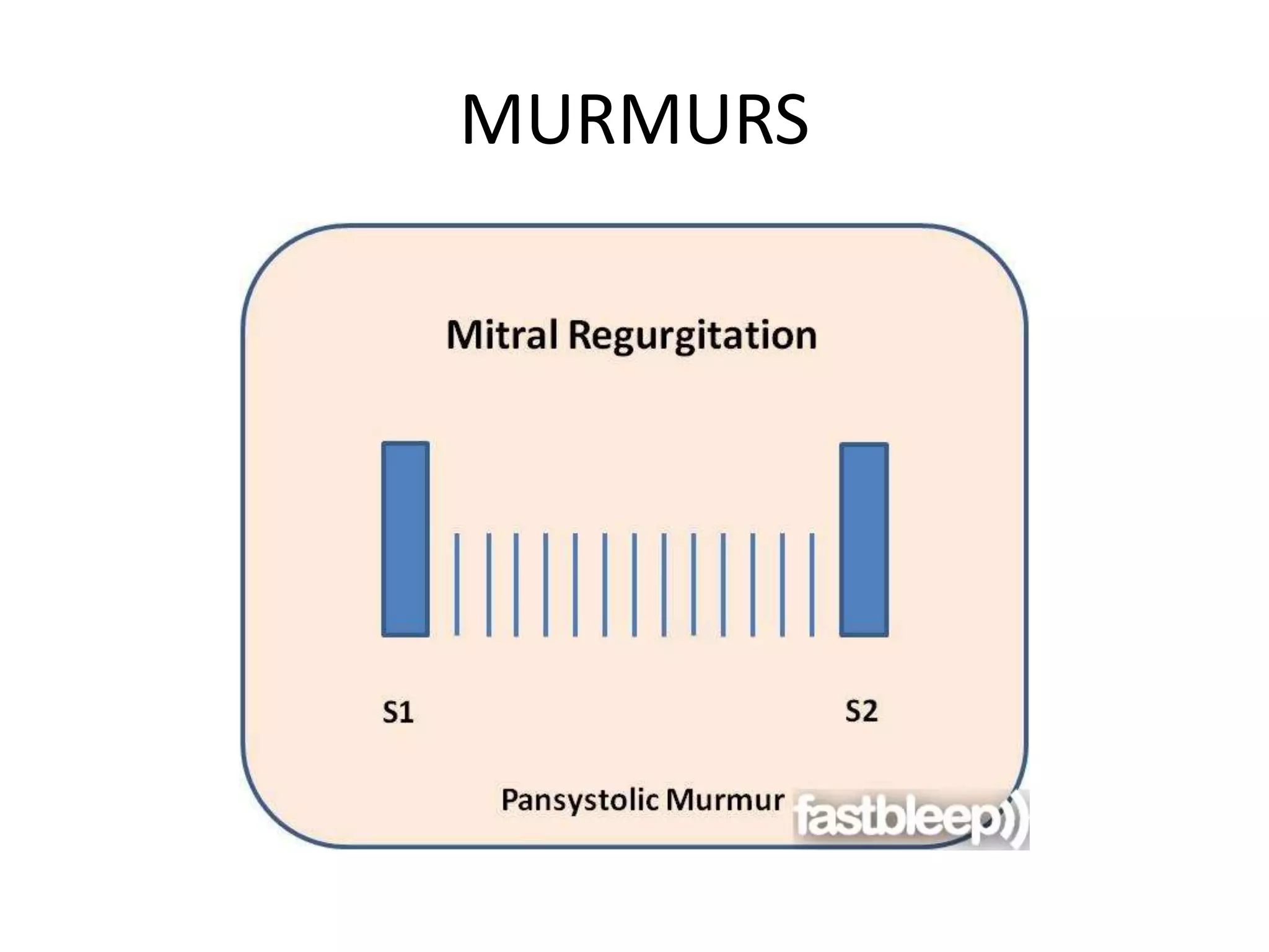 MURMURS