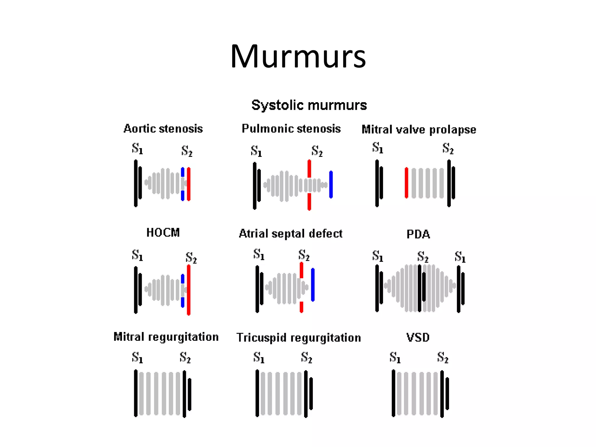 Murmurs