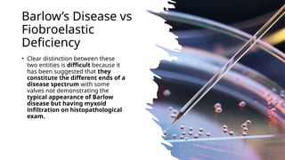 Barlow’s Disease vs
Fiobroelastic
Deficiency
• Clear distinction between these
two entities is difficult because it
has been suggested that they
constitute the different ends of a
disease spectrum with some
valves not demonstrating the
typical appearance of Barlow
disease but having myxoid
infiltration on histopathological
exam.
 