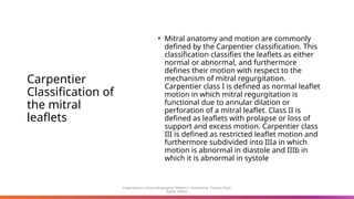 Carpentier
Classification of
the mitral
leaflets
• Mitral anatomy and motion are commonly
defined by the Carpentier classification. This
classification classifies the leaflets as either
normal or abnormal, and furthermore
defines their motion with respect to the
mechanism of mitral regurgitation.
Carpentier class I is defined as normal leaflet
motion in which mitral regurgitation is
functional due to annular dilation or
perforation of a mitral leaflet. Class II is
defined as leaflets with prolapse or loss of
support and excess motion. Carpentier class
III is defined as restricted leaflet motion and
furthermore subdivided into IIIa in which
motion is abnormal in diastole and IIIb in
which it is abnormal in systole
Feigenbaum’s echocardiography / William F. Armstrong, Thomas Ryan.
Eighth edition
 