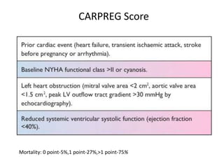 Mortality: 0 point-5%,1 point-27%,>1 point-75%
CARPREG Score
 