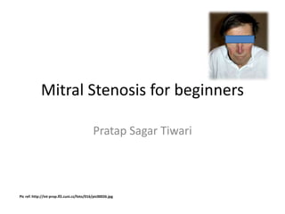 Mitral Stenosis for beginners
Pratap Sagar Tiwari
Pic ref: http://int-prop.lf2.cuni.cz/foto/016/pic00026.jpg
 