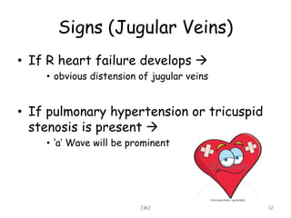 Signs (Jugular Veins)
• If R heart failure develops 
• obvious distension of jugular veins
• If pulmonary hypertension or tricuspid
stenosis is present 
• ‘a’ Wave will be prominent
JMJ 12
 