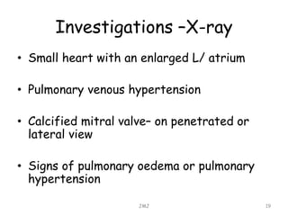 Investigations –X-ray
• Small heart with an enlarged L/ atrium
• Pulmonary venous hypertension
• Calcified mitral valve– on penetrated or
lateral view
• Signs of pulmonary oedema or pulmonary
hypertension
JMJ 19
 