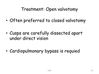 Treatment: Open valvotomy
• Often preferred to closed valvotomy
• Cusps are carefully dissected apart
under direct vision
• Cardiopulmonary bypass is requied
JMJ 30
 