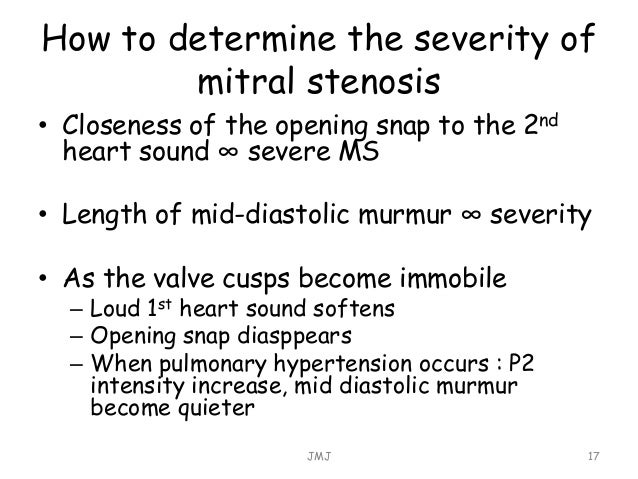 mitral stenosis