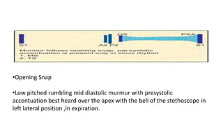 Mitral stenosis