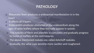  Rheumatic fever produces a widespread manifestation in in the
heart.
 It affects all 3 layers.
 Endocarditis produces ulceration of the endocardium along the
ages of valve leaflets where they normally appose in systole.
 Tiny nodules of fibrin and platelets accumulates and gradually progress
to fusion of leaflets at the commissures.
 The above mentioned nodules are called Ashchoff nodules.
 Gradually, the valve cups become more swollen and roughened.
 