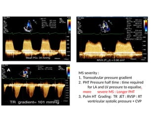 Tr Jet Rvsp MITRAL STENOSIS anesthesia for mitral stenosis.pptx