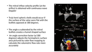 Mitral Inflow Letters transesophageal echoacrdiography evaluation of mitral stenosis | PPTX