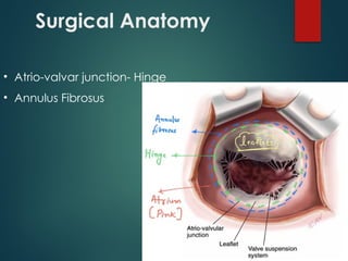 Valvar Mitral Stenosis- Pathophysiology, diagnosis and management | PPTX