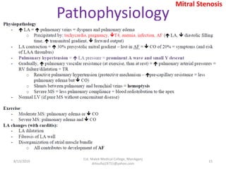 Pathophysiology
8/13/2019
Col. Malek Medical College, Manikganj
drtoufiq19711@yahoo.com
15
Mitral Stenosis
 
