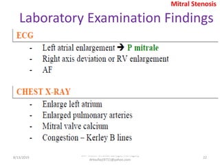 8/13/2019
Col. Malek Medical College, Manikganj
drtoufiq19711@yahoo.com
22
Laboratory Examination Findings
Mitral Stenosis
 