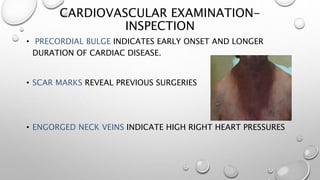 CARDIOVASCULAR EXAMINATION-
INSPECTION
• PRECORDIAL BULGE INDICATES EARLY ONSET AND LONGER
DURATION OF CARDIAC DISEASE.
• SCAR MARKS REVEAL PREVIOUS SURGERIES
• ENGORGED NECK VEINS INDICATE HIGH RIGHT HEART PRESSURES
 