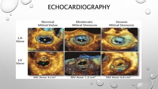 ECHOCARDIOGRAPHY
 