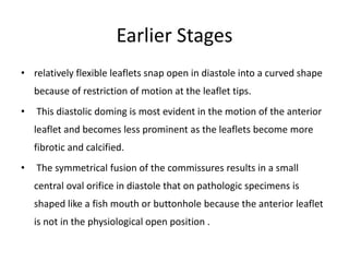Earlier Stages
• relatively flexible leaflets snap open in diastole into a curved shape
because of restriction of motion at the leaflet tips.
• This diastolic doming is most evident in the motion of the anterior
leaflet and becomes less prominent as the leaflets become more
fibrotic and calcified.
• The symmetrical fusion of the commissures results in a small
central oval orifice in diastole that on pathologic specimens is
shaped like a fish mouth or buttonhole because the anterior leaflet
is not in the physiological open position .
 