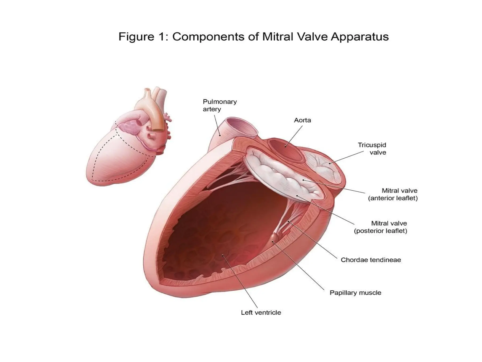 Mitral_Valve_Anatomy_Surgical_Perspective[1].pptx