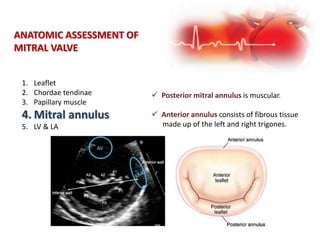 ANATOMIC ASSESSMENT OF
MITRAL VALVE
1. Leaflet
2. Chordae tendinae
3. Papillary muscle
4. Mitral annulus
5. LV & LA
 Posterior mitral annulus is muscular.
 Anterior annulus consists of fibrous tissue
made up of the left and right trigones.
 