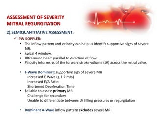 2).SEMIQUANTITATIVE ASSESSMENT:
ASSESSMENT OF SEVERITY
MITRAL REGURGITATION
 PW DOPPLER:
• The inflow pattern and velocity can help us identify supportive signs of severe
MR.
• Apical 4 window.
• Ultrasound beam parallel to direction of flow.
• Velocity informs us of the forward stroke volume (SV) across the mitral valve.
• E-Wave Dominant: supportive sign of severe MR
Increased E Wave (> 1.2 m/s)
Increased E/A Ratio
Shortened Deceleration Time
• Reliable to assess primary MR
Challenge for secondary
Unable to differentiate between LV filling pressures or regurgitation
• Dominant A-Wave inflow pattern excludes severe MR
 