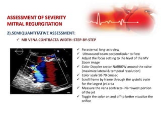 ASSESSMENT OF SEVERITY
MITRAL REGURGITATION
2).SEMIQUANTITATIVE ASSESSMENT:
 MR VENA CONTRACTA WIDTH: STEP-BY-STEP
 Parasternal long-axis view
 Ultrasound beam perpendicular to flow
 Adjust the focus setting to the level of the MV
Zoom image
 Color Doppler sector NARROW around the valve
(maximize lateral & temporal resolution)
 Color scale 50-70 cm/sec
 Scroll frame by frame through the systolic cycle
for the largest jet area
 Measure the vena contracta- Narrowest portion
of the jet
 Toggle the color on and off to better visualize the
orifice
 