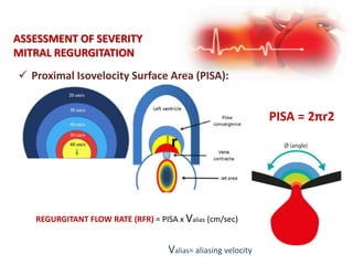 ASSESSMENT OF SEVERITY
MITRAL REGURGITATION
 Proximal Isovelocity Surface Area (PISA):
PISA = 2πr2
r
REGURGITANT FLOW RATE (RFR) = PISA x Valias (cm/sec)
Valias= aliasing velocity
 