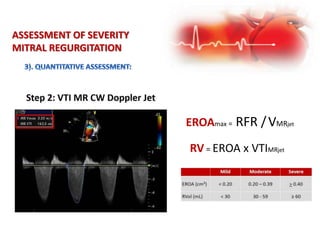 ASSESSMENT OF SEVERITY
MITRAL REGURGITATION
EROAmax = RFR /VMRjet
RV = EROA x VTIMRjet
 