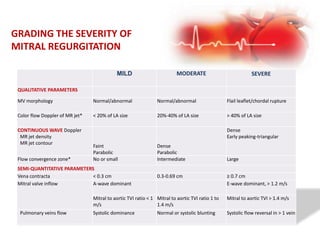 GRADING THE SEVERITY OF
MITRAL REGURGITATION
MILD MODERATE SEVERE
QUALITATIVE PARAMETERS
MV morphology Normal/abnormal Normal/abnormal Flail leaflet/chordal rupture
Color flow Doppler of MR jet* < 20% of LA size 20%-40% of LA size > 40% of LA size
CONTINUOUS WAVE Doppler
MR jet density
MR jet contour
Faint
Parabolic
Dense
Parabolic
Dense
Early peaking-triangular
Flow convergence zone* No or small Intermediate Large
SEMI-QUANTITATIVE PARAMETERS
Vena contracta < 0.3 cm 0.3-0.69 cm ≥ 0.7 cm
Mitral valve inflow A-wave dominant E-wave dominant, > 1.2 m/s
Mitral to aortic TVI ratio < 1
m/s
Mitral to aortic TVI ratio 1 to
1.4 m/s
Mitral to aortic TVI > 1.4 m/s
Pulmonary veins flow Systolic dominance Normal or systolic blunting Systolic flow reversal in > 1 vein
 