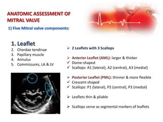 ANATOMIC ASSESSMENT OF
MITRAL VALVE
1. Leaflet
2. Chordae tendinae
3. Papillary muscle
4. Annulus
5. Commissures, LA & LV
 2 Leaflets with 3 Scallops
 Anterior Leaflet (AML): larger & thicker
 Dome-shaped
 Scallops: A1 (lateral), A2 (central), A3 (medial)
 Posterior Leaflet (PML): thinner & more flexible
 Crescent shaped
 Scallops: P1 (lateral), P2 (central), P3 (medial)
 Leaflets thin & pliable
 Scallops serve as segmental markers of leaflets
 