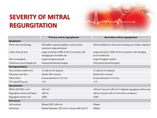 SEVERITY OF MITRAL
REGURGITATION
 