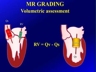 Mitral valve current challenges