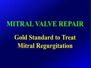 Mitral valve current challenges