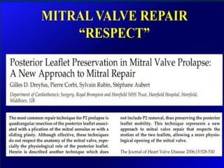 Mitral valve current challenges