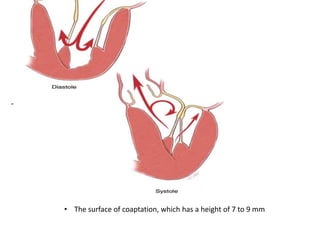 • The surface of coaptation, which has a height of 7 to 9 mm
 