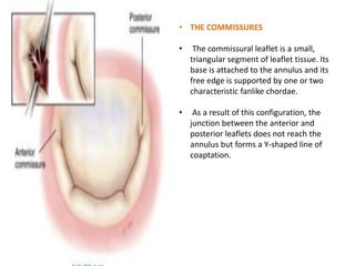 • THE COMMISSURES
• The commissural leaflet is a small,
triangular segment of leaflet tissue. Its
base is attached to the annulus and its
free edge is supported by one or two
characteristic fanlike chordae.
• As a result of this configuration, the
junction between the anterior and
posterior leaflets does not reach the
annulus but forms a Y-shaped line of
coaptation.
 