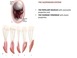THE SUSPENSION SYSTEM
• THE PAPILLARY MUSCLES with contractile
properties and
• THE CHORDAE TENDINEAE with elastic
properties.
 