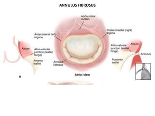 ANNULUS FIBROSUS
 
