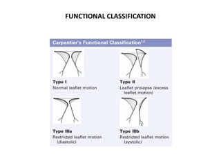 FUNCTIONAL CLASSIFICATION
 