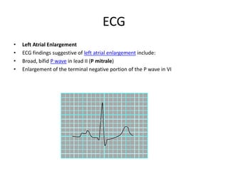 ECG
• Left Atrial Enlargement
• ECG findings suggestive of left atrial enlargement include:
• Broad, bifid P wave in lead II (P mitrale)
• Enlargement of the terminal negative portion of the P wave in VI
 