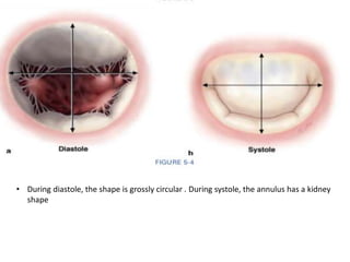 • During diastole, the shape is grossly circular . During systole, the annulus has a kidney
shape
 