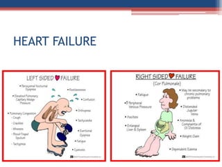 Mitral valve disease 2020 | PPT